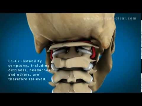 Dureri de umăr diagnosticate