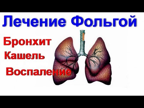 Что может болеть на пояснице с двух сторон Укладка тазобедренного сустава