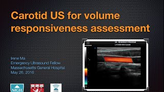 Carotid ultrasound for volume responsiveness assessment