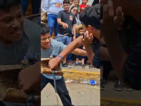 Mira cómo quedó al final 😮 El costo de ser Chinegro #Nicaragua