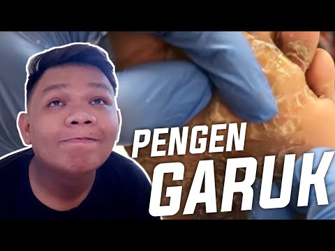 tangan-gua-jadi-gatal-extreme-satisfying