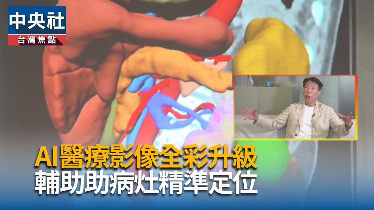 AI醫療影像全彩升級  助病灶精準定位
