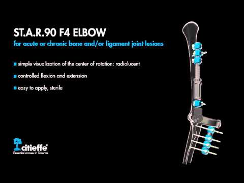 Citieffe - Articulated Elbow External Fixator ST.A.R.90 F4 ELBOW (Trauma and Orthopaedic Surgery)