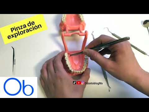 Pinza de exploración