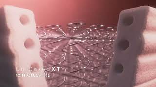 Sealy Posturepedic | Exquisite 2024 – Features & Benefits