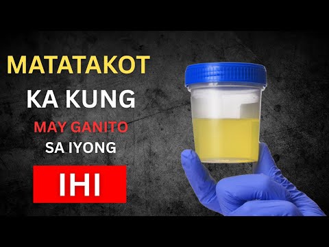 Paano mo Malalaman kung may STD kang tulo?  Walang sintomas ang karamihan.