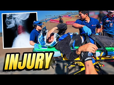 I Finally Crashed my $20,000 Surron 