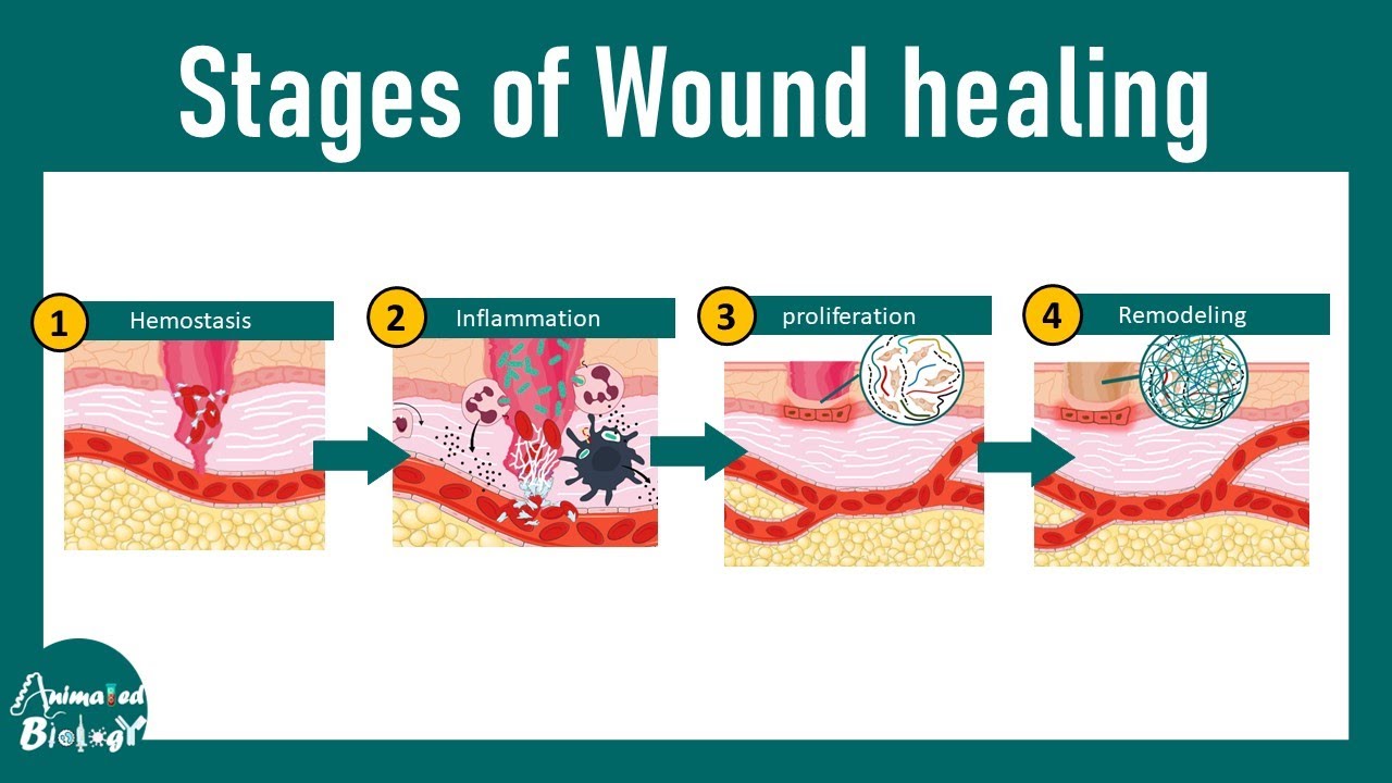 Wound healing stages | steps of wound healing | Wound healing and injury