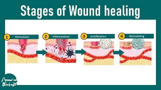 Wound healing stages | steps of wound healing | Wound healing and injury