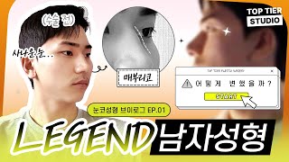 확실한 변화!? 남자 눈·코 성형 솔직 후기 브이로그 1탄ㅣ탑티어성형외과