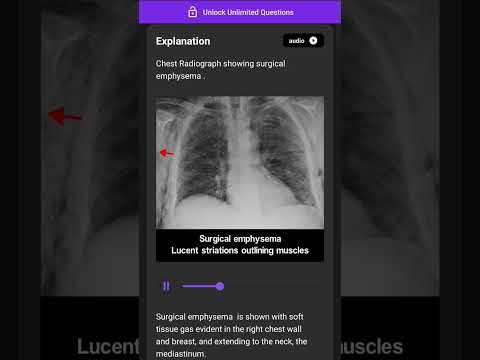 daily update diagnosis 📚💯 #anatomy #medical imaging #ct #xray #science #xray #Million #shorts