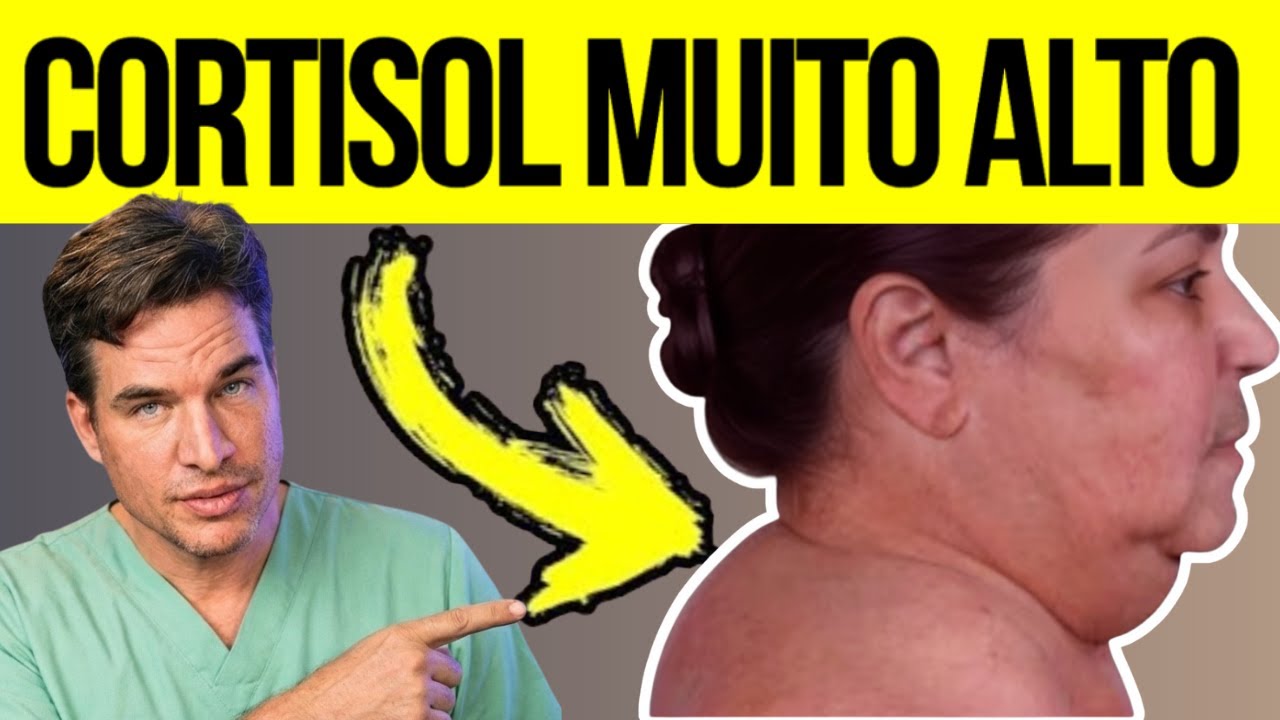 7 SIGNS of HIGH CORTISOL in the body | How to LOWER CORTISOL NATURALLY (best foods)