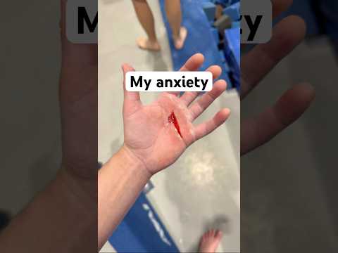 The Real Reason Gymnasts Wear Grips!!