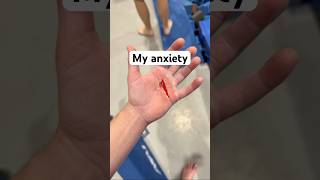 The Real Reason Gymnasts Wear Grips!!