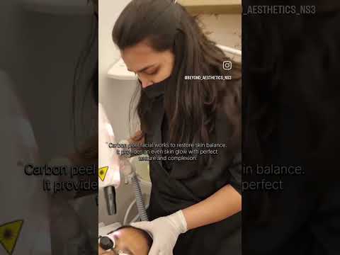 Carbon Laser Peel | Beyond Aesthetics