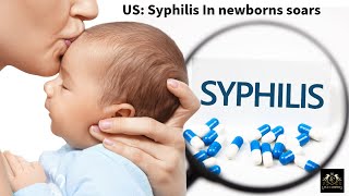 Shocking Rise in Syphilis Cases for US Infants