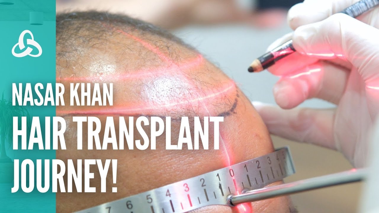 Grow Stronger with UniquEra Hair Transplant