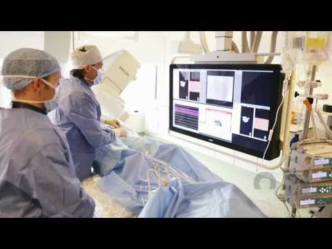 Catharina Hartcentrum: Catharina Ziekenhuis en Philips verlagen weer dosis röntgenstralen