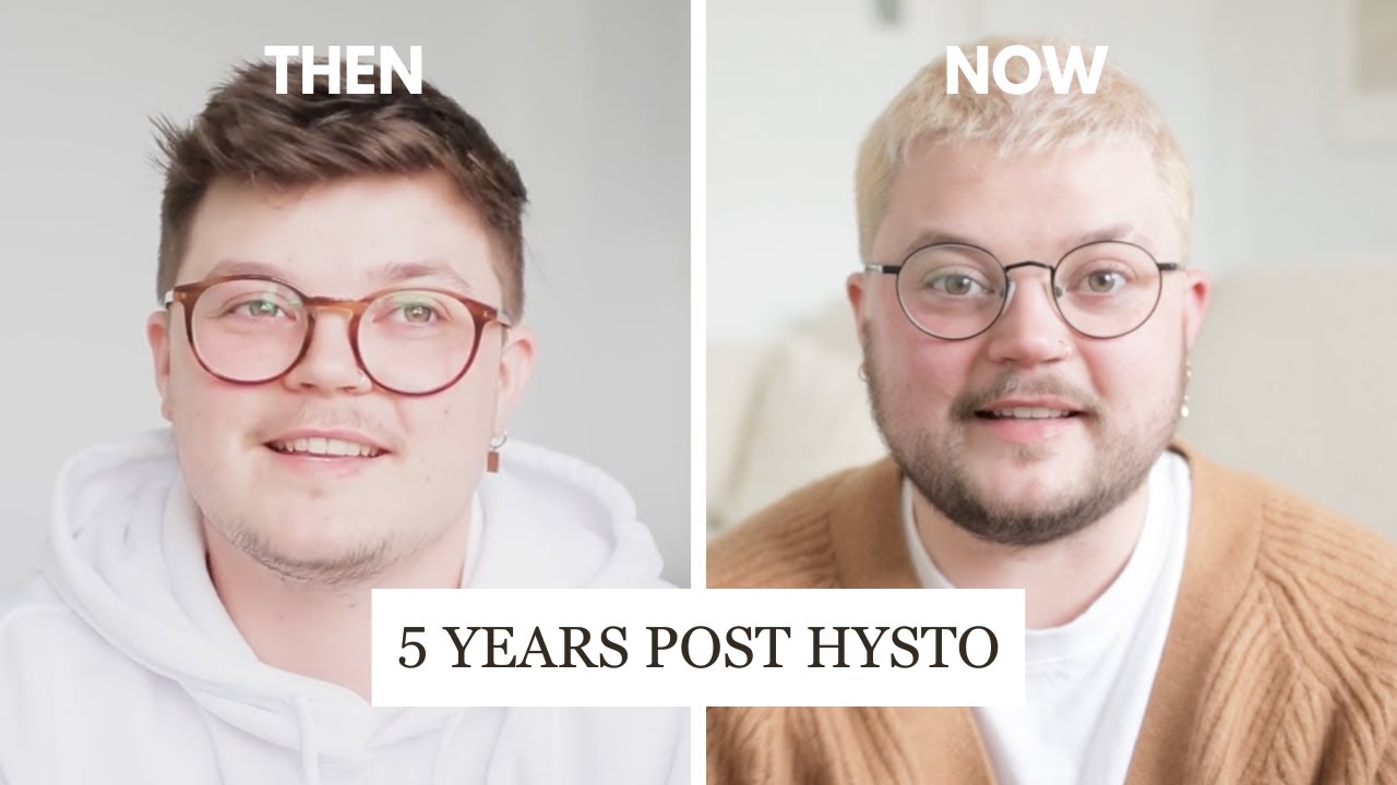 A Brutally Honest Hysterectomy Q+A | FTM