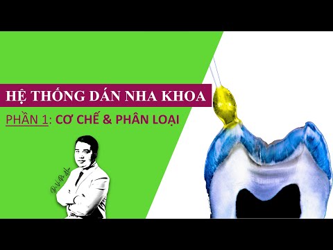 Hệ thống Dán Nha khoa | Fase 1: Cơ chế & Phân loại