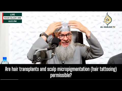 Hair Transplant, Scalp Micropigmentation (hair tattoo) Microblading #haram #halal assim al hakeem