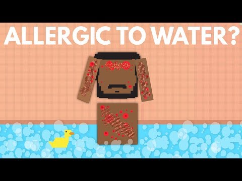 What Would Happen If You Were Allergic To Water? - YouTube