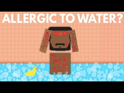 What Would Happen If You Were Allergic To Water? Video
