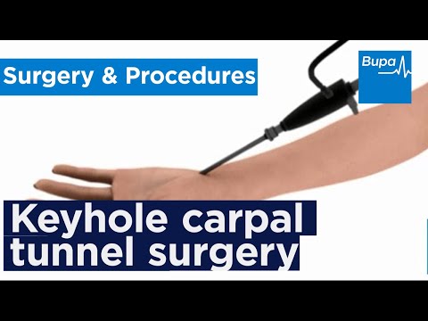 How keyhole carpal tunnel surgery is carried out | Bupa Health