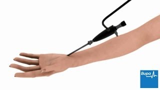 How keyhole carpal tunnel surgery is carried out