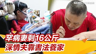 罕病妻剩16公斤　深情夫顧20年苦養家