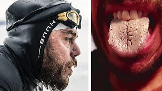 157 ДНЕЙ ОН ПЛАВАЛ В ОТКРЫТОМ МОРЕ! ПОСМОТРИТЕ, ЧТО С НИМ СТАЛО