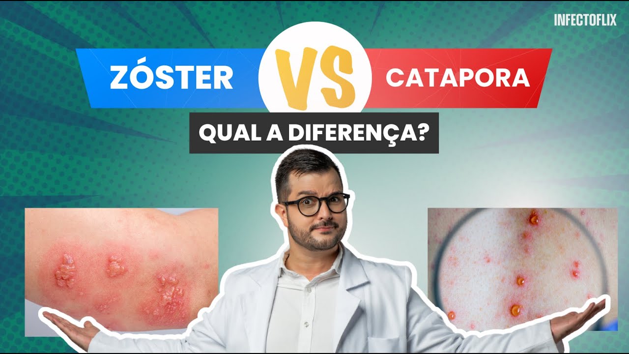 Bruno Fernando Buzo-1