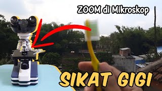 Download lagu SIKAT GIGI di MIKROSKOP | Tooth Brush Under Microscope mp3 Download lagu SIKAT GIGI di MIKROSKOP | Tooth Brush Under Microscope mp3