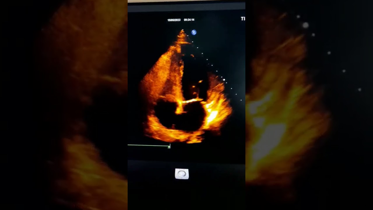 Luis Erik Olivares Sánchez-5