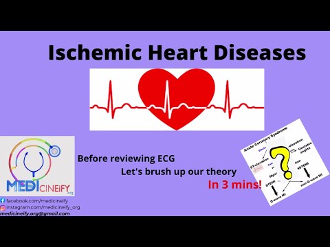Ischemic Heart Diseases(IHD) classification for ECG.