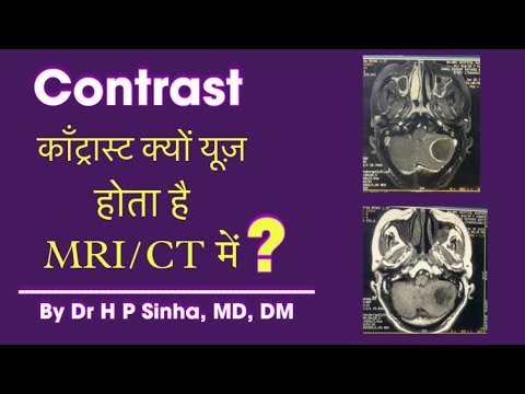 MRI / CT scan में Contrast की ज़रूरत कब पड़ती है ?| Dr HP Sinha MD DM Neurologist |