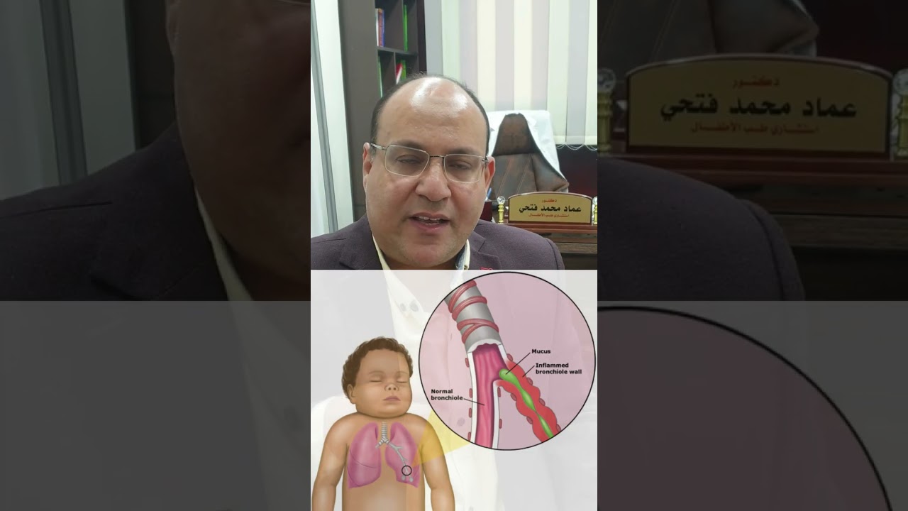 الالتهاب الشعيبي الدقيق في الأطفال أقل من سنتين يشبه حساسية الصدر (Bronchiolitis)