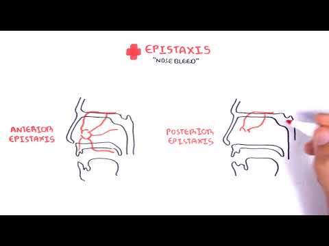 Clinical Anatomy -  Nasal Cavity and Nose bleeds