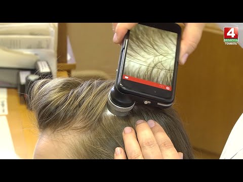 Выпадение волос или даже облысение. Постковидные угрозы видео