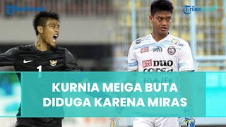 Bukan Disantet, Ini Penyebab Kurnia Meiga Idap Penyakit Mata Langka hingga Buta, Diduga karena Miras