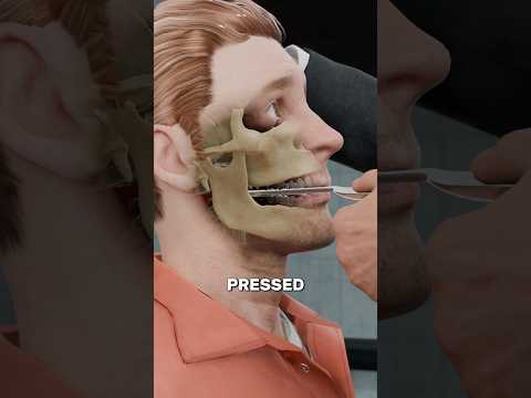 How a Spoon Could Silence a Leak 🥄