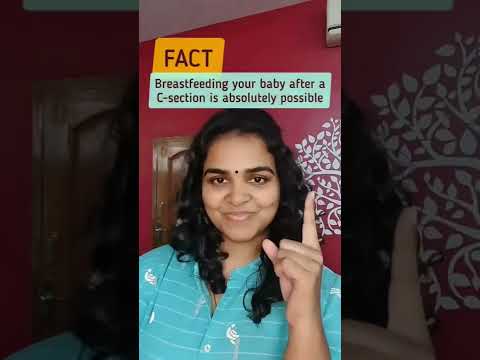 Breastfeeding after a C-section