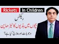 Rickets Disease - Causes & Treatment | Rickets In Children | By Dr. Khalid Jamil