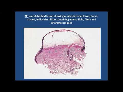 Lecture-48: Bullous Pemphigoid and related diseases, Part-I. Rook's chapter 50.