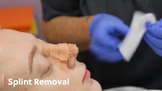Splint Removal at Zenith