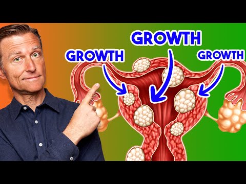 Over 50% of Women Have THIS?!