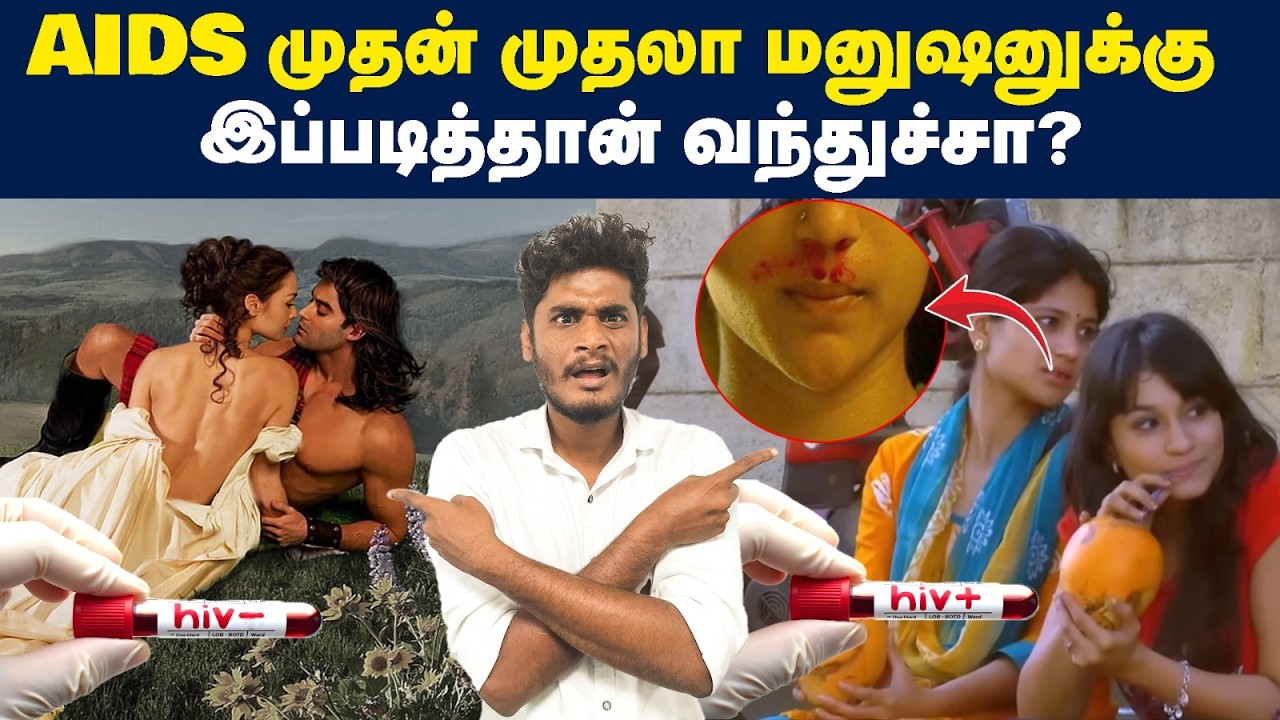 😱🤯குரங்கில் இருந்து வந்துச்சா? | How humans got AIDS for first time | How humans got