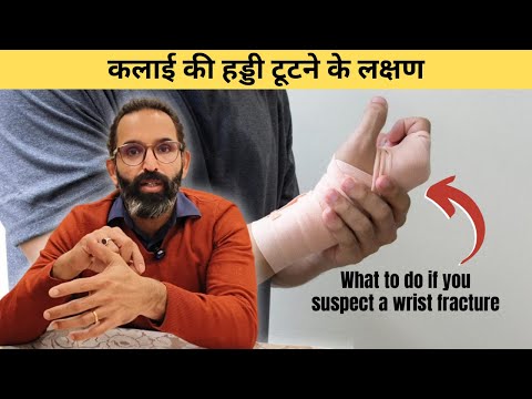 Symptoms of wrist bone fracture | Wrist Fracture | Scaphoid Fracture | Wrist Fracture Exercise in...