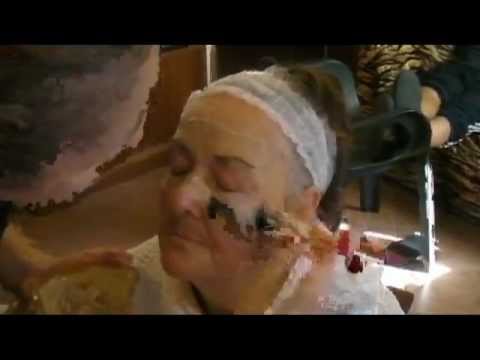 Il bambino sotto occhi ha cerchi azzurri sotto occhi Se può dopo Botox la palpebra superiore cadrà