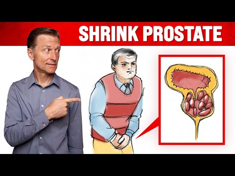 Shrink Your ENLARGED PROSTATE and Fix Urine Flow